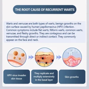 Official Store ✅|🌟 𝑽𝒊𝒕𝒂𝒍𝒊𝒔𝒚𝒔 𝑷𝒂𝒊𝒏𝒍𝒆𝒔𝒔 𝑩𝒊𝒐-𝑪𝒓𝒚𝒐𝒈𝒆𝒏 𝒕𝒆𝒄𝒉𝒏𝒐𝒍𝒐𝒈𝒚 𝑹𝒆𝒎𝒐𝒗𝒂𝒍 𝑾𝒂𝒓𝒕 𝑺𝒑𝒓𝒂𝒚| 👩‍⚕️ Instantly Remove Warts, Skin Tags & Moles – Painlessly & Safely| backed by science